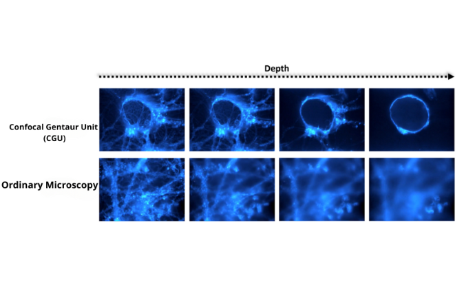 The difference between the results of the Confocal Gentaur Unit and ordinary microscopy.