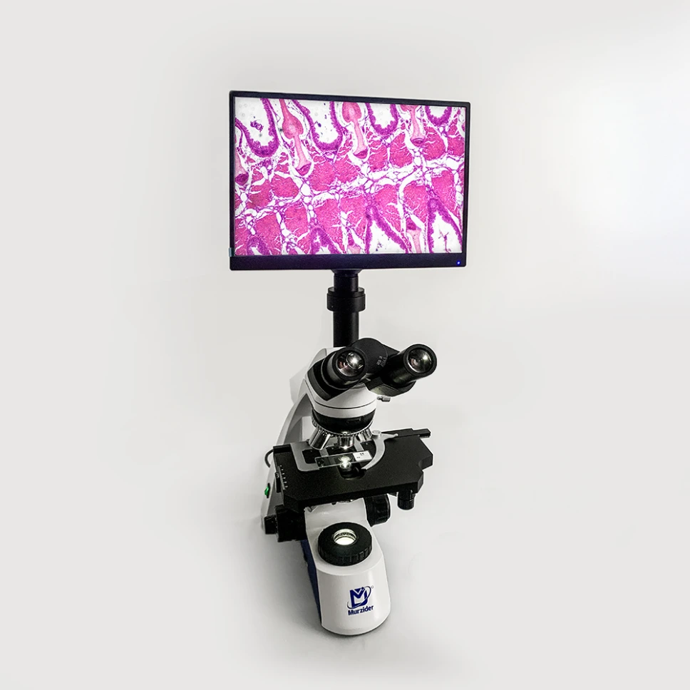 [MSD-S760+11.6Y] Research Grade Biological microscope + 11.6 inch display screen